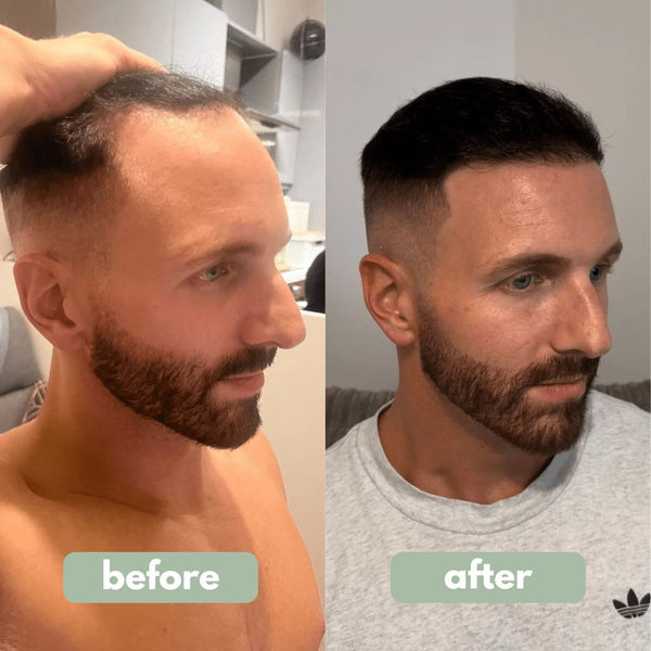 Hair Revival Growth Serum