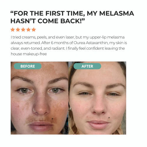 Glow & Renew Skin Supplement